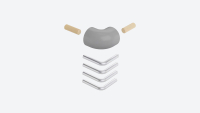 Corner kit for landing banister BOSTON Pearl grey